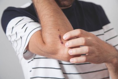 Beyaz bir adam yaralanmış. Kazaydı.