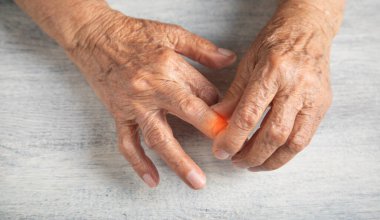 Kafkasyalı yaşlı kadın elinde acıdan muzdarip.