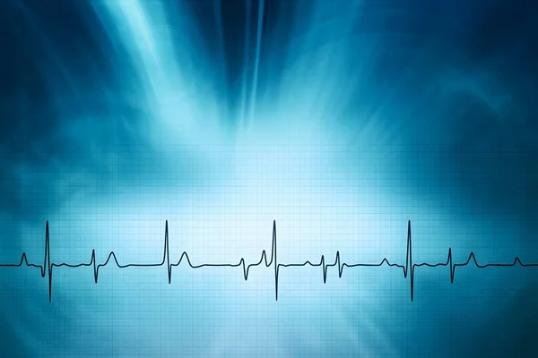 Radyasyon mavi arka planda stilize ECG dalgalanması, kalp fonksiyonlarını ve tıbbi teşhisleri sembolize ediyor.