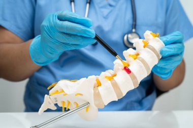 Omurga ve kemik modeli taşıyan Asyalı doktor, ortopedi bölümünde tedavi için bel kemiği yerinden oynamış disk parçası..