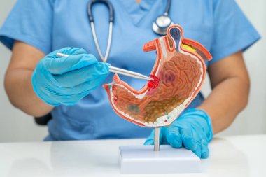 Mide hastalığı, hastanede teşhis ve tedavi için anatomi modeli tutan bir doktor..