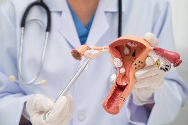 Rahim, hastanede teşhis ve tedavi için insan anatomisi modeli tutan doktor..