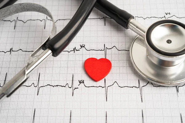 Elektrokardiyogram EKG, kalp dalgası, kalp krizi, kardiyogram raporu.