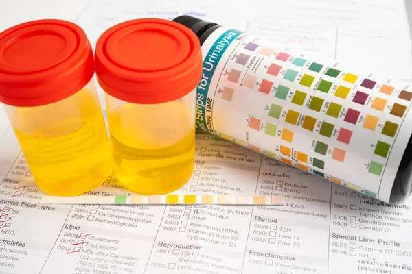 İdrar tahlili, reaksiyonlu idrar kabı. PH kağıt testi ve karşılaştırma tablosu laboratuvarda..