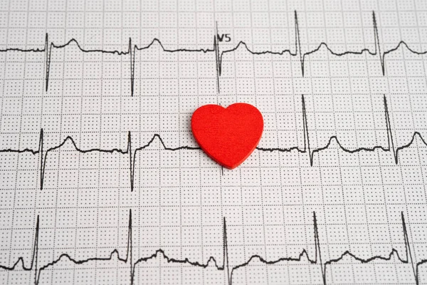 Elektrokardiyogram EKG, kalp dalgası, kalp krizi, kardiyogram raporu.