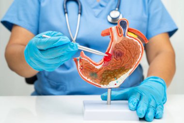 Mide hastalığı, hastanede teşhis ve tedavi için anatomi modeli tutan bir doktor..