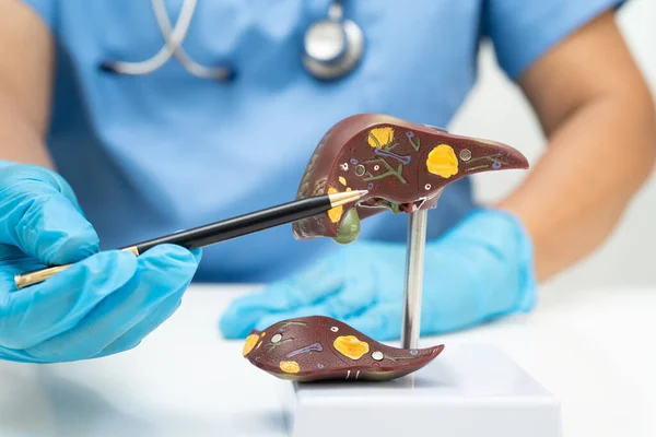 Dünya Hepatit Günü 'nde siroz, karaciğer kanseri, yağlı karaciğer, karaciğer anatomisi olan Asyalı doktor..