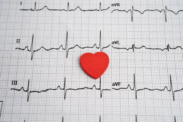 Elektrokardiyogram EKG, kalp dalgası, kalp krizi, kardiyogram raporu.