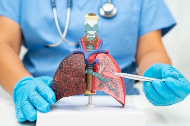 Siroz, karaciğer kanseri, yağlı karaciğer, karaciğer anatomisi olan Asyalı kadın..