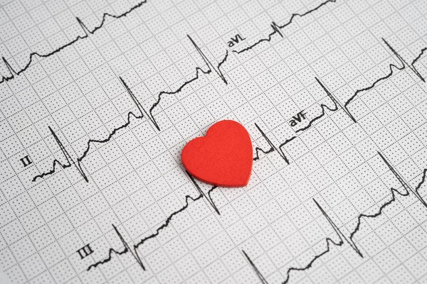 Elektrokardiyogram EKG, kalp dalgası, kalp krizi, kardiyogram raporu.