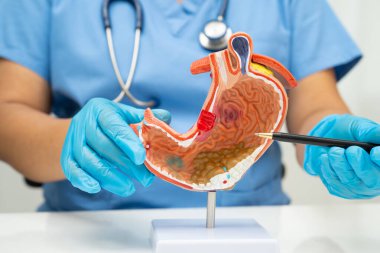 Mide hastalığı, hastanede teşhis ve tedavi için anatomi modeli tutan bir doktor..