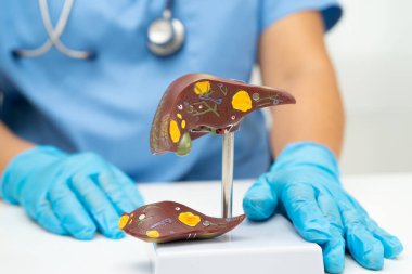 Dünya Hepatit Günü 'nde siroz, karaciğer kanseri, yağlı karaciğer, karaciğer anatomisi olan Asyalı doktor..