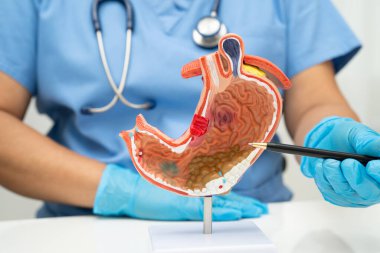 Mide hastalığı, hastanede teşhis ve tedavi için anatomi modeli tutan bir doktor..
