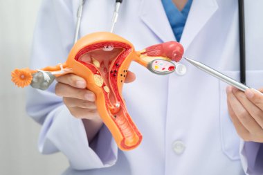 Rahim, hastanede teşhis ve tedavi için insan anatomisi modeli tutan doktor..