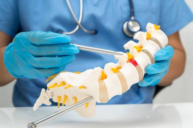 Omurga ve kemik modeli taşıyan Asyalı doktor, ortopedi bölümünde tedavi için bel kemiği yerinden oynamış disk parçası..