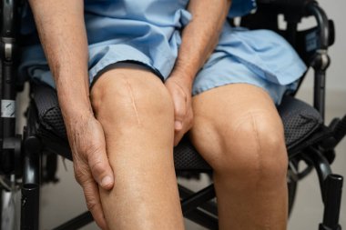 Hastanede dizinde yara izi olan Asyalı yaşlı bir hasta var..