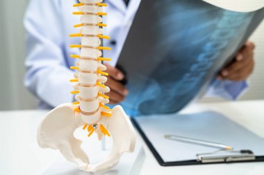 Doktor omurga röntgen filmini inceliyor..