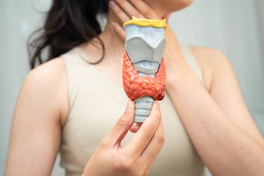 Hipertiroidizm, aşırı aktif tiroid, tiroid lenfoma, tiroid bezi insan anatomisi olan Asyalı kadın..