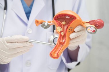 Rahim, hastanede teşhis ve tedavi için insan anatomisi modeli tutan doktor..
