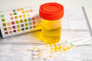 İdrar tahlili, reaksiyonlu idrar kabı. PH kağıt testi ve karşılaştırma tablosu laboratuvarda..