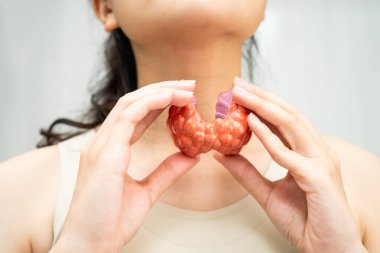 Hipertiroidizm, aşırı aktif tiroid, tiroid lenfoma, tiroid bezi insan anatomisi olan Asyalı kadın..