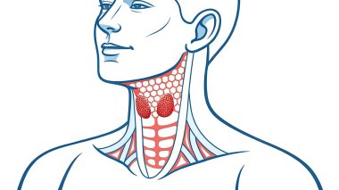 Bu anatomik çizim insan tiroid bezini, etrafındaki boyun yapısını ve tiroid nodüllerini gösteriyor. Tıp eğitimi ve tiroid sağlık durumlarını anlamak için kullanışlı.