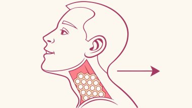 This image illustrates the human thyroid gland's anatomy and precise location within the neck. It's a key endocrine organ shown in a detailed diagram for medical and educational purposes.