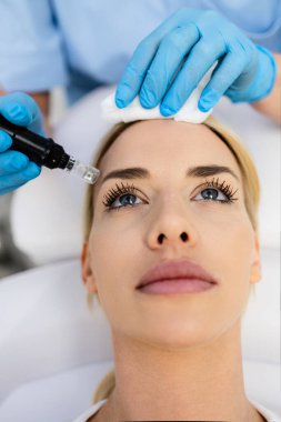 Microneedle mesotherapy. Beautiful blond woman receiving microneedling rejuvenation treatment. clipart