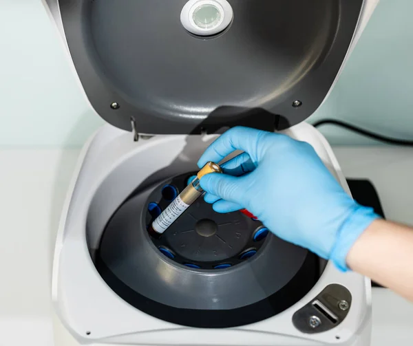 Close up shot of Lab clinical centrifuge device for serum separation from the blood or plasma later used for platelet rich plasma PRP therapy process.