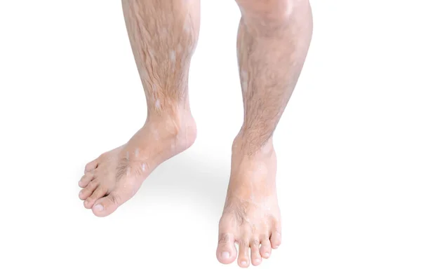 Blisko Nogi Człowieka Biorąc Prysznic Odizolowany Białym Tle Opieki Zdrowotnej — Zdjęcie stockowe