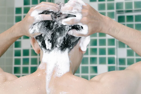 Junger Mann Ernstes Haarausfall Problem Für Gesundheitswesen Medizinisches Und Shampoo — Stockfoto