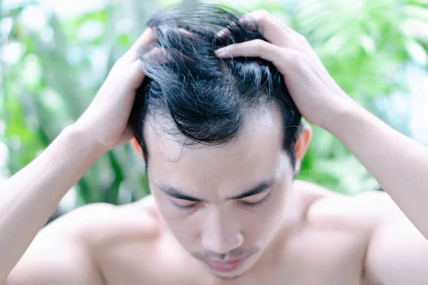 Giovane Uomo Grave Problema Perdita Dei Capelli Assistenza Sanitaria Medico — Foto Stock