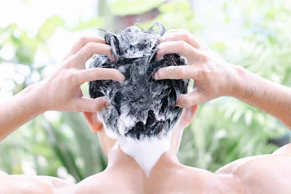 Junger Mann Ernstes Haarausfall Problem Für Medizinische Versorgung Und Shampoo — Stockfoto