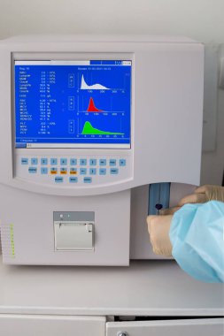 Bir tıp laboratuarı asistanı bir analizciye kan testi yapar. Aygıta bir test tüpü ekler.