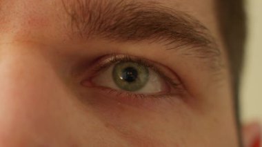Göz kapağı seğirmesi videoyu kapatır. Alt kapak rastgele hareket ediyor ve kontrolsüz bir şekilde sallanıyor. Erkek hasta yorgun ve semptomları var..