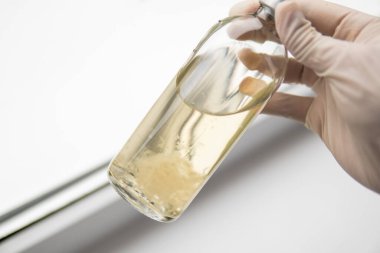 Sihirli mantar yetiştir. Psilosibe cubensis. İlaçlar, mantar ekimi. Psilosibin mantarı. Miselyumun sıvı kültürü.