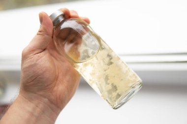 Sıvı miselyum kültürü. Mantar ekimi. Psikedelik mikrodoz büyüt. Psilosibin mantarı. Sihirli mantar. Psilosibe cubensis.