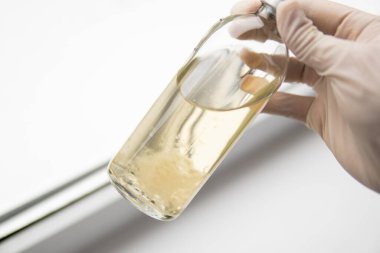 Sıvı miselyum kültürü. Psilosibin mantarı. Sihirli mantar yetiştir. Psilosibe cubensis. İlaçlar Mantar ekimi.