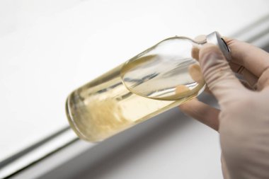 Grow Magic mushroom. Psilocybin mushroom. Liquid culture of mycelium. Psilocybe cubensis. Psilocybe cubensis. Medicines Mushroom cultivation.