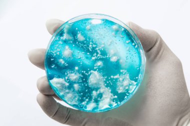 Mantar miselyum petri kabı. Laboratuvar aksesuarları. Agar 'da mantar miselyumu. Reishi mantarı miselyumu patates dekstroz agar üzerinde. Petri kabında büyüyen mitoloji.