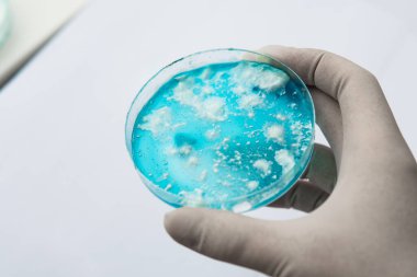 Reishi mantarı miselyumu patates dekstroz agar üzerinde. Mantar miselyum petri kabı. Petri kabında büyüyen mikoloji. Beyaz arka plan. Laboratuvar aksesuarları.