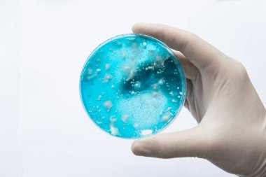Agar 'da mantar miselyumu. Petri kabında büyüyen mikoloji. Reishi mantarı miselyumu patates dekstroz agar üzerinde. Laboratuvar aksesuarları. Beyaz arka plan. Mantar miselyum petri