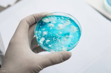 Laboratuvar aksesuarları. Agar 'da mantar miselyumu. Reishi mantarı miselyumu patates dekstroz agar üzerinde. Mantar miselyum petri kabı. Petri kabında büyüyen mikoloji. Beyaz arkaplan.