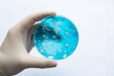 Agar 'da mantar miselyumu. Reishi mantarı miselyumu patates dekstroz agar üzerinde. Laboratuvar aksesuarları. Beyaz arka plan. Mantar miselyum petri kabı. Petri kabında büyüyen mitoloji.