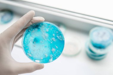 Mantar miselyum petri kabı. Petri kabında büyüyen mikoloji. Laboratuvar aksesuarları. Agar 'da mantar miselyumu. Beyaz arka plan. Reishi mantarı miselyumu patates dekstroz agar.