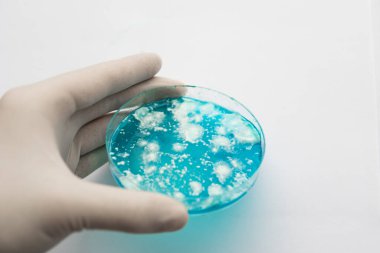 Petri kabında büyüyen mikoloji. Agar 'da mantar miselyumu. Reishi mantarı miselyumu patates dekstroz agar üzerinde. Beyaz arka plan. Laboratuvar aksesuarları. Mantar miselyum petri kabı.