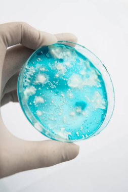 Mantar miselyum petri kabı. Laboratuvar aksesuarları. Reishi mantarı miselyumu patates dekstroz agar üzerinde. Agar 'da mantar miselyumu. Petri kabında büyüyen mikoloji. Beyaz arkaplan.