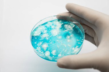 Reishi mantarı miselyumu patates dekstroz agar üzerinde. Beyaz arka plan. Laboratuvar aksesuarları. Mantar miselyum petri kabı. Petri kabında büyüyen mikoloji. Agar 'da mantar miselyumu.