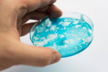 Mantar miselyum petri kabı. Laboratuvar aksesuarları. Reishi mantarı miselyumu patates dekstroz agar üzerinde. Petri kabında büyüyen mikoloji. Beyaz arka plan. Agar 'da mantar miselyumu.