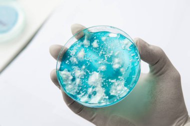 Mantar miselyum petri kabı. Laboratuvar aksesuarları. Agar 'da mantar miselyumu. Reishi mantarı miselyumu patates dekstroz agar üzerinde. Petri kabında büyüyen mikoloji. Beyaz arkaplan.